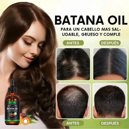 Aceite de Batana 100% puro||Devuelve la vida a tu cabello||🔥Promo 2 piezas🔥