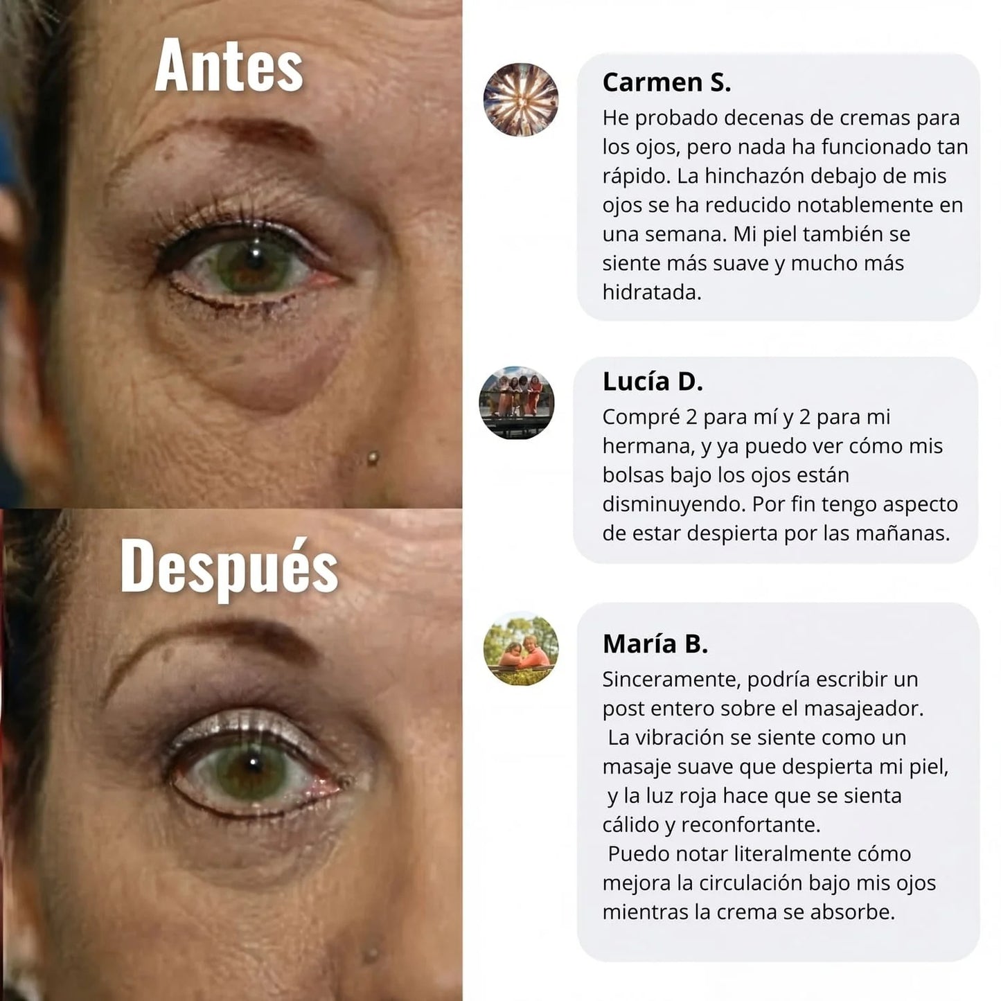 Wombea™ Crema de luz roja para contorno de ojos