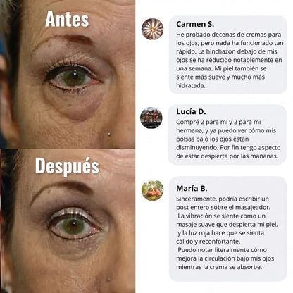 Wombea™ Crema de luz roja para contorno de ojos